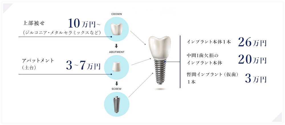 当院のインプラント治療の費用