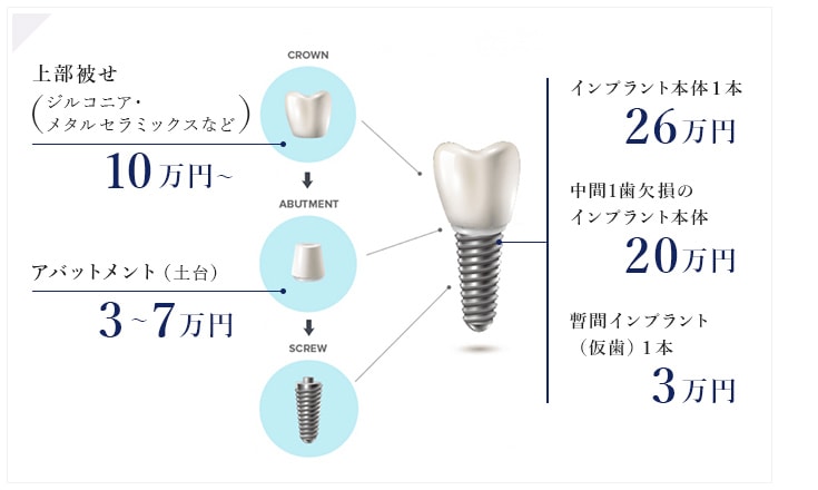 当院のインプラント治療の費用