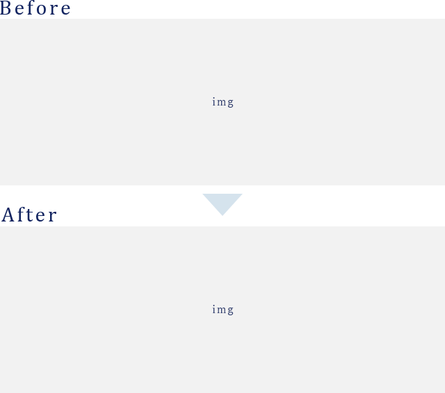 Before After